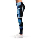 X-Ray Film Radiology Print Women's Leggings