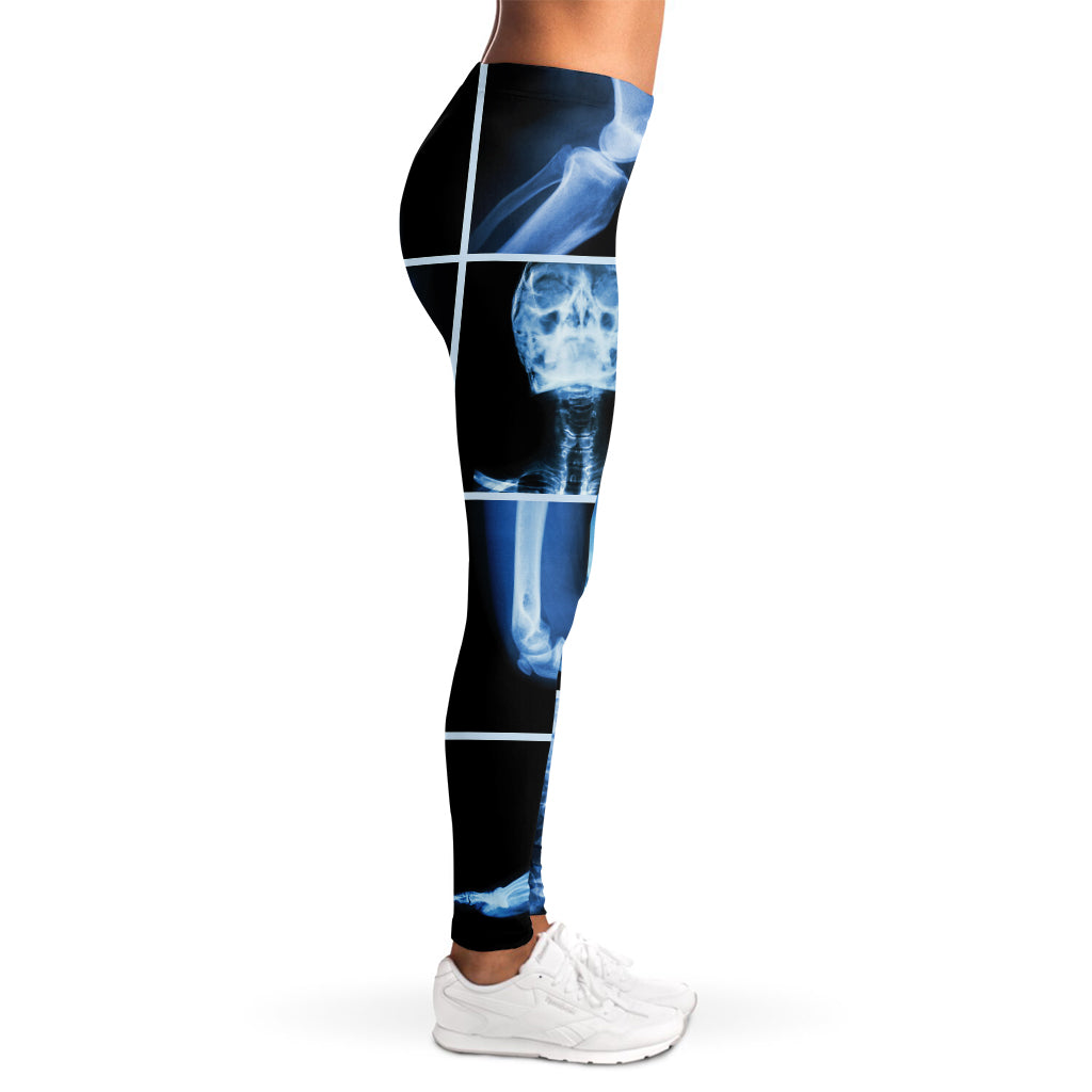 X-Ray Film Radiology Print Women's Leggings