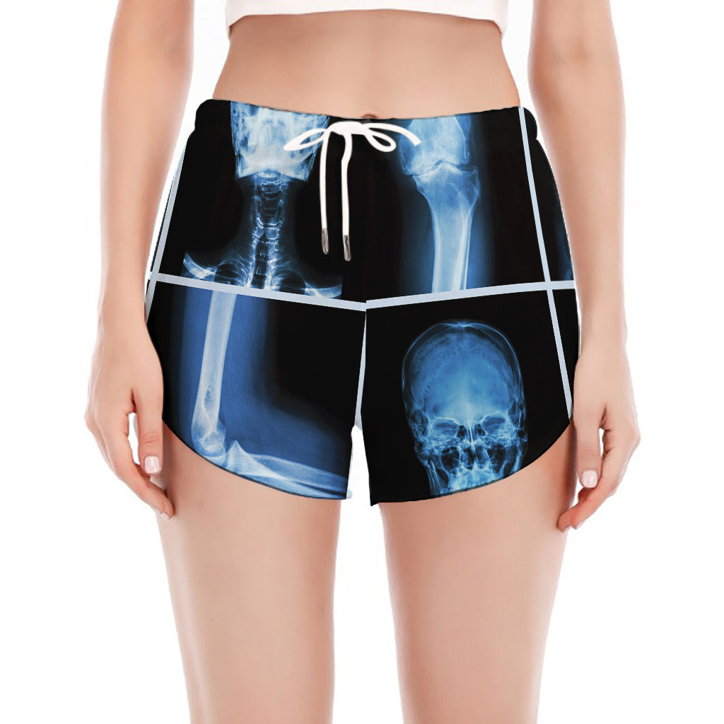 X-Ray Film Radiology Print Women's Split Running Shorts