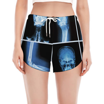 X-Ray Film Radiology Print Women's Split Running Shorts
