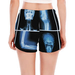 X-Ray Film Radiology Print Women's Split Running Shorts