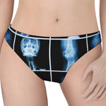 X-Ray Film Radiology Print Women's Thong
