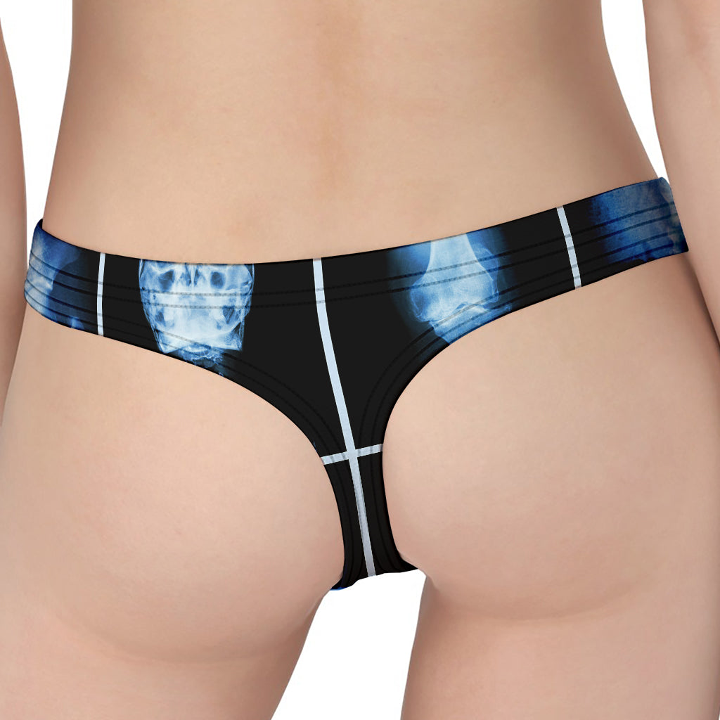X-Ray Film Radiology Print Women's Thong