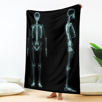 Human Skeleton X-Ray Print Blanket