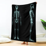 Human Skeleton X-Ray Print Blanket
