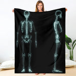 Human Skeleton X-Ray Print Blanket