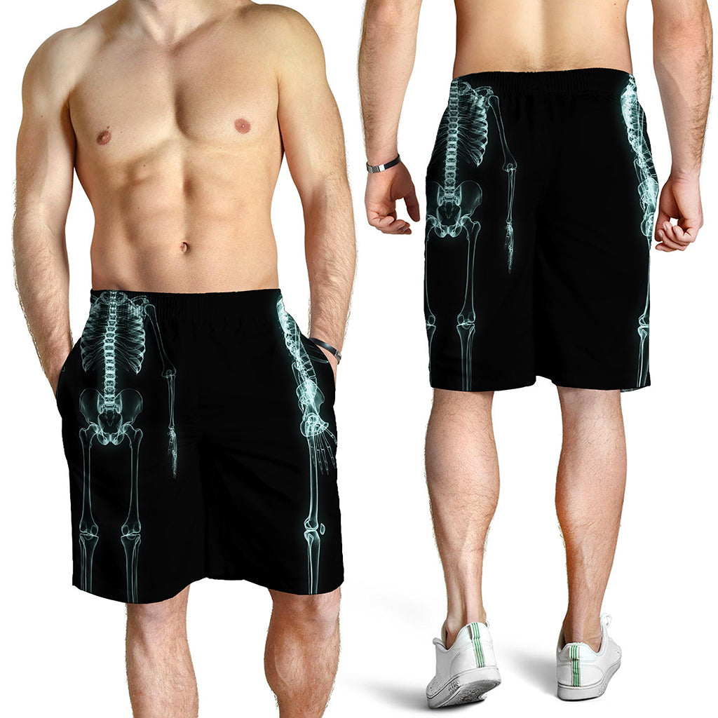 Human Skeleton X-Ray Print Men's Shorts