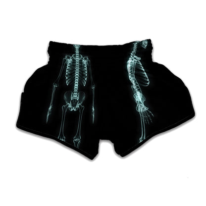 Human Skeleton X-Ray Print Muay Thai Boxing Shorts