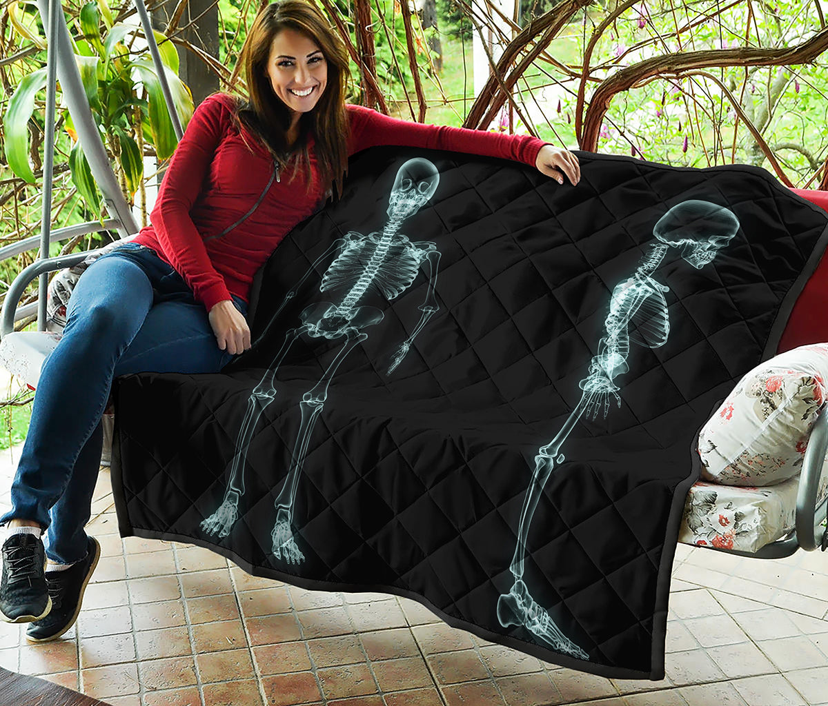 Human Skeleton X-Ray Print Quilt