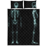 Human Skeleton X-Ray Print Quilt Bed Set