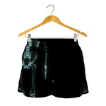 Human Skeleton X-Ray Print Women's Shorts