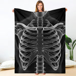 Radiologist X-Ray Film Print Blanket