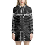 Radiologist X-Ray Film Print Hoodie Dress