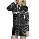 Radiologist X-Ray Film Print Hoodie Dress