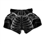 Radiologist X-Ray Film Print Muay Thai Boxing Shorts