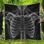 Radiologist X-Ray Film Print Quilt