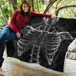 Radiologist X-Ray Film Print Quilt