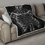 Radiologist X-Ray Film Print Quilt