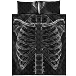 Radiologist X-Ray Film Print Quilt Bed Set