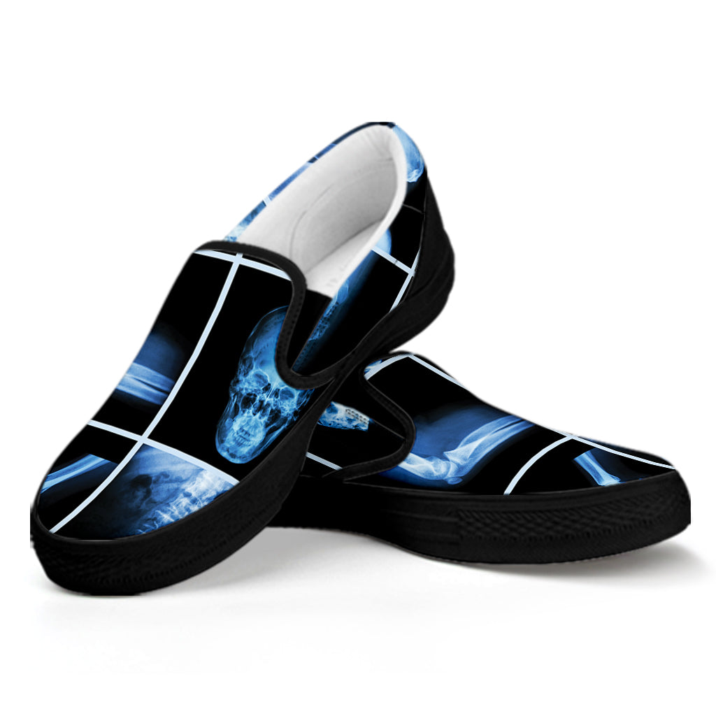 X-Ray Film Radiology Print Black Slip On Shoes