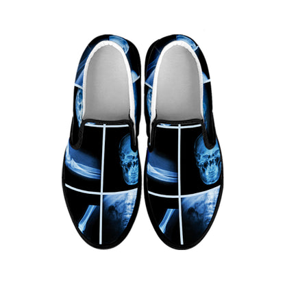 X-Ray Film Radiology Print Black Slip On Shoes