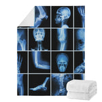 X-Ray Film Radiology Print Blanket