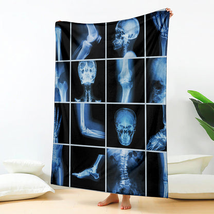 X-Ray Film Radiology Print Blanket