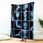 X-Ray Film Radiology Print Blanket