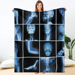 X-Ray Film Radiology Print Blanket