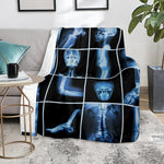 X-Ray Film Radiology Print Blanket