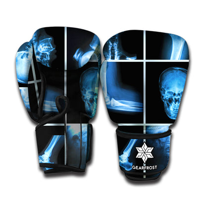 X-Ray Film Radiology Print Boxing Gloves
