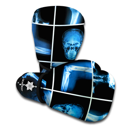 X-Ray Film Radiology Print Boxing Gloves