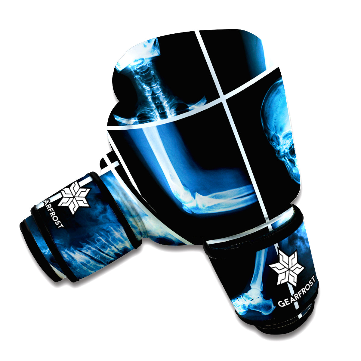 X-Ray Film Radiology Print Boxing Gloves