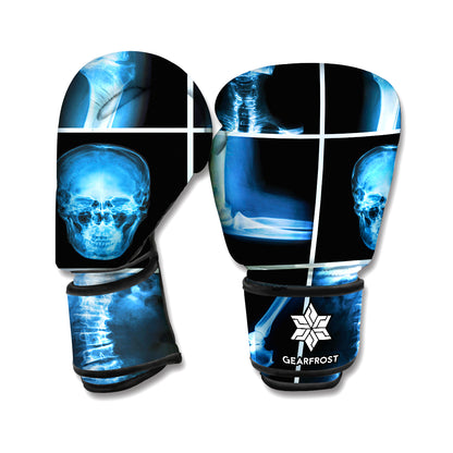 X-Ray Film Radiology Print Boxing Gloves