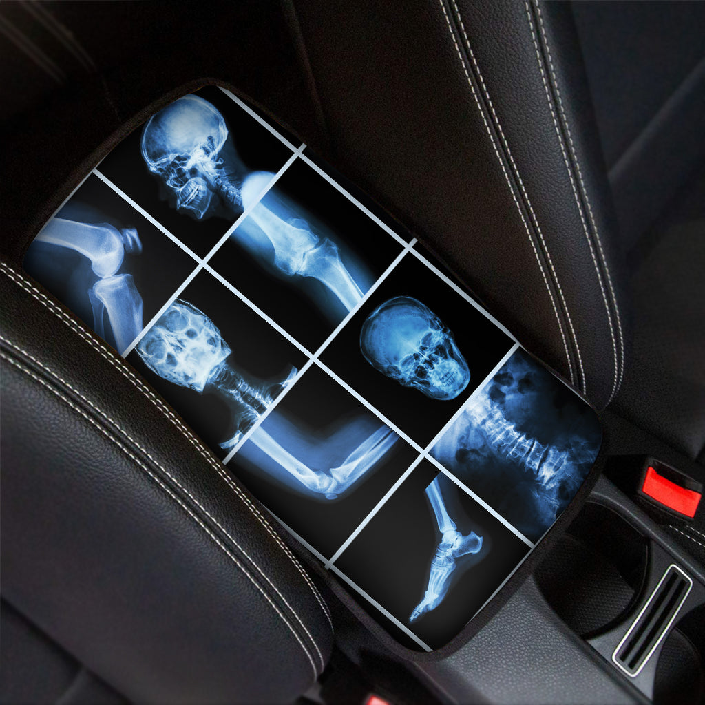 X-Ray Film Radiology Print Car Center Console Cover