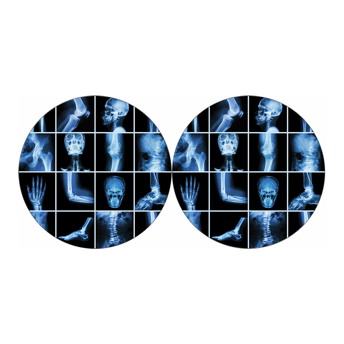 X-Ray Film Radiology Print Car Coasters