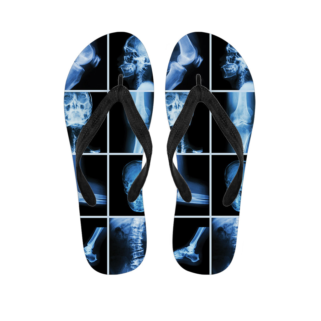 X-Ray Film Radiology Print Flip Flops