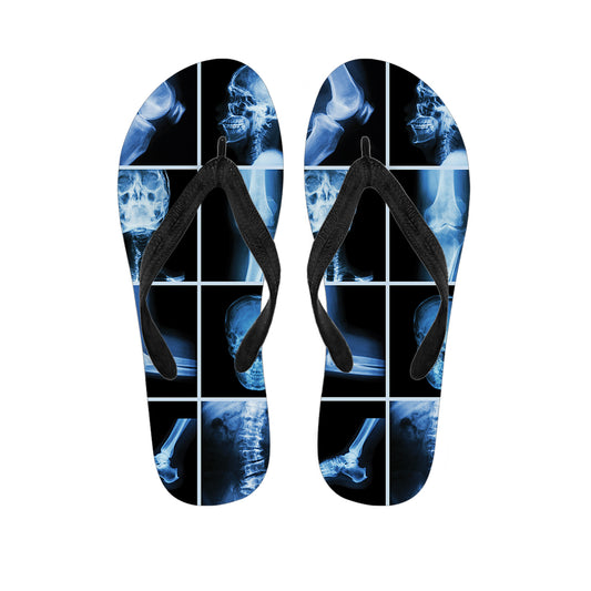 X-Ray Film Radiology Print Flip Flops