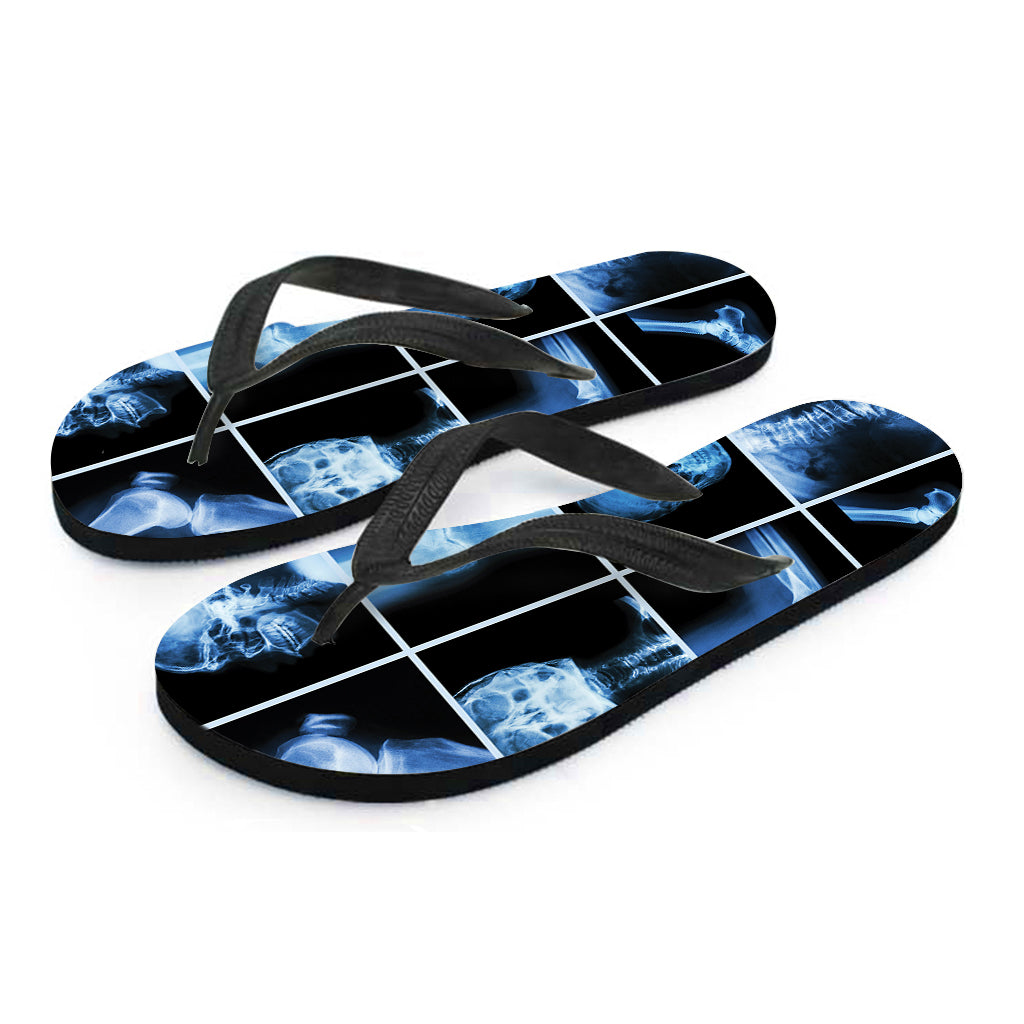 X-Ray Film Radiology Print Flip Flops