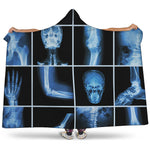 X-Ray Film Radiology Print Hooded Blanket
