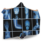 X-Ray Film Radiology Print Hooded Blanket