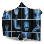 X-Ray Film Radiology Print Hooded Blanket