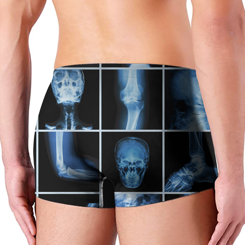 X-Ray Film Radiology Print Men's Boxer Briefs