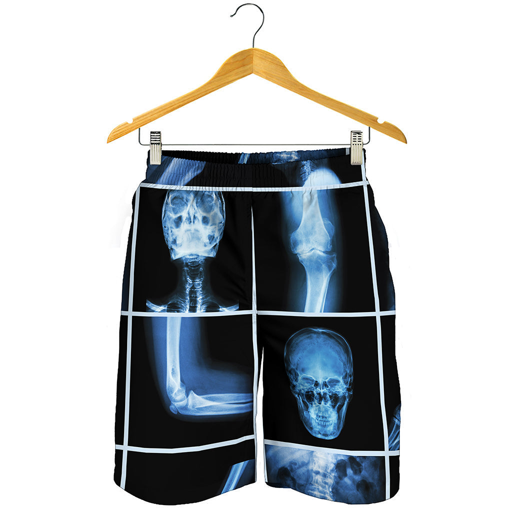 X-Ray Film Radiology Print Men's Shorts