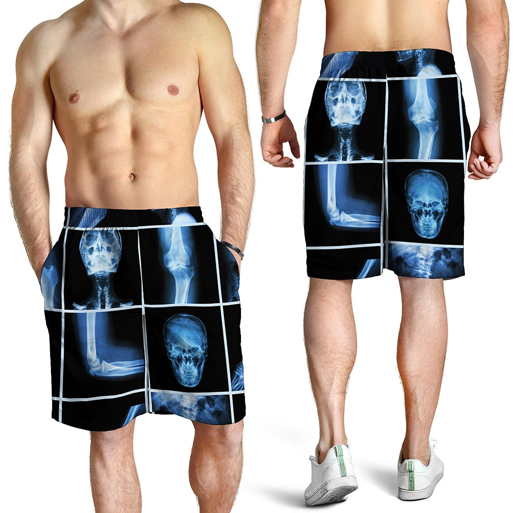 X-Ray Film Radiology Print Men's Shorts