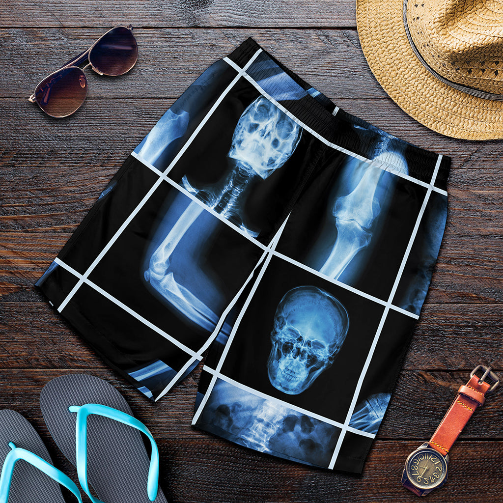 X-Ray Film Radiology Print Men's Shorts