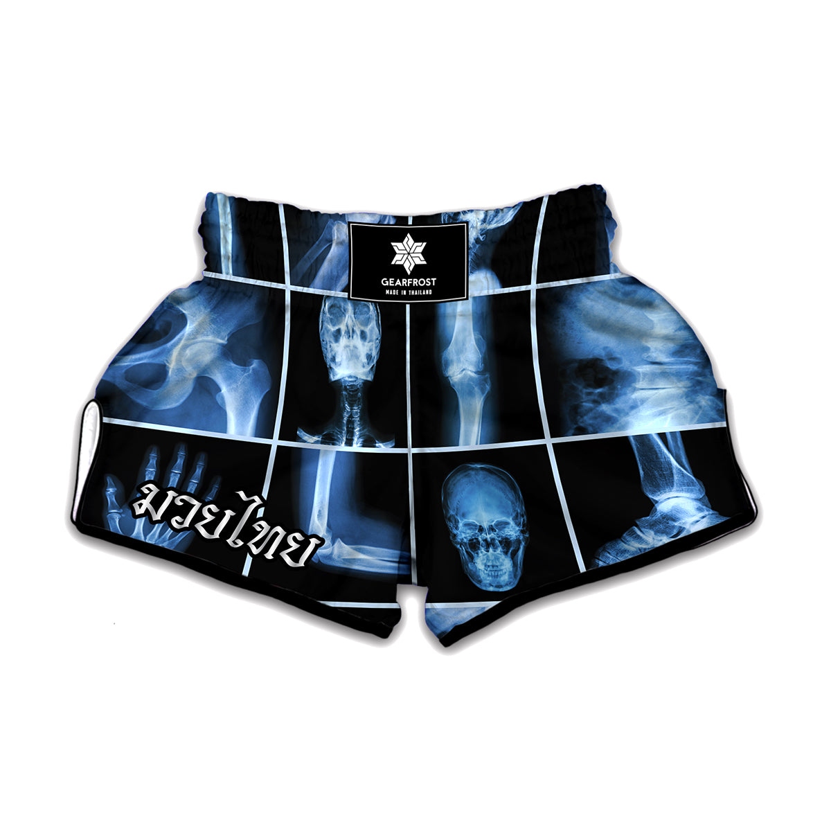 X-Ray Film Radiology Print Muay Thai Boxing Shorts