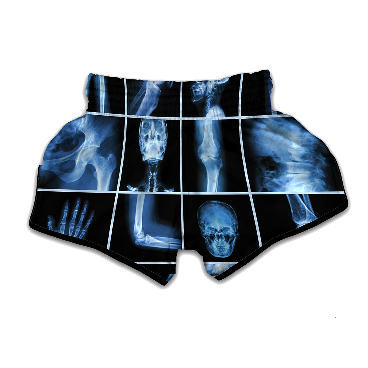 X-Ray Film Radiology Print Muay Thai Boxing Shorts