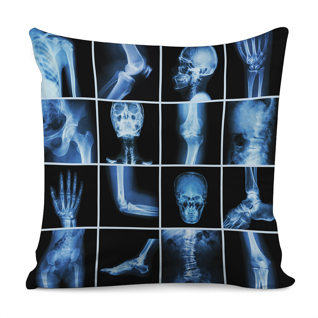 X-Ray Film Radiology Print Pillow Cover