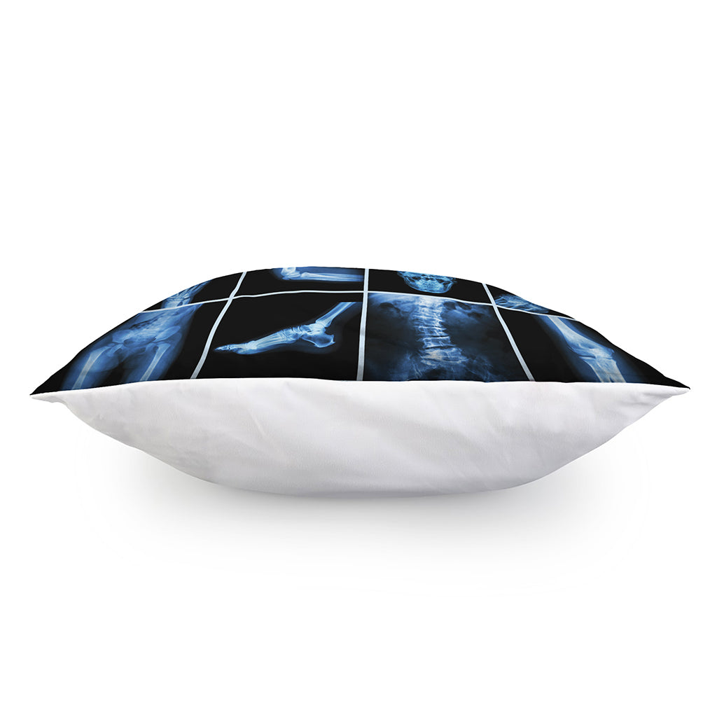 X-Ray Film Radiology Print Pillow Cover